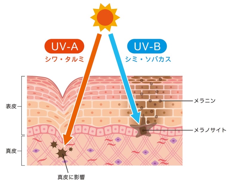 肌図　紫外線ダメージ